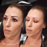 eyebrow microblading in tampa fl